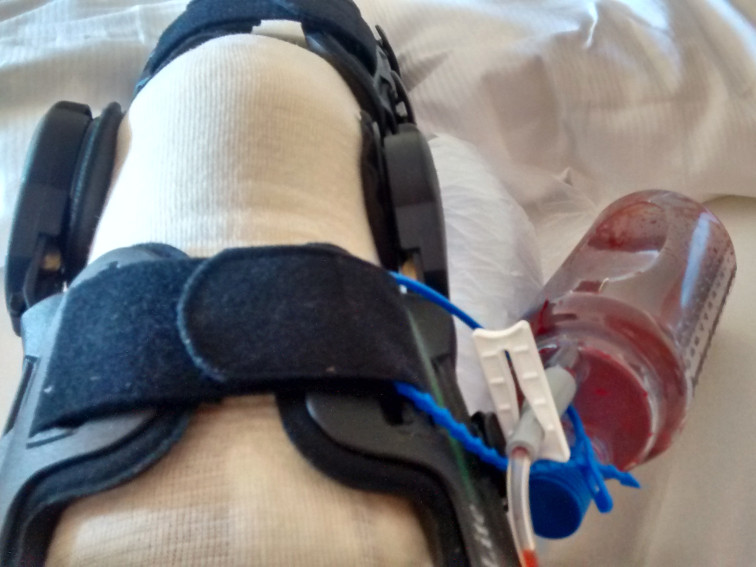 20 Punkte Die Dein Risiko Fur Infektionen Im Kniegelenk Reduzieren Knie Marathon Knie Op Reha Patienten Aufgepasst