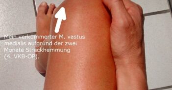 Vastus medialis trainieren: 3 Übungen für deinen Oberschenkel Vastus medialis trainiern - Drei Übungen